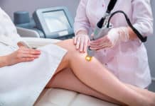 8 choses à savoir avant de se faire épiler au laser Epilation au laser